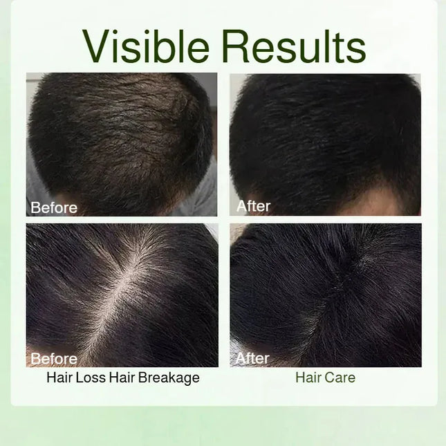 EcoWarra Natural Usman Grass Herbal Shampoo Bar – Oil Control, Anti-Dandruff & Hair Growth Care